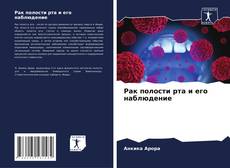 Borítókép a  Рак полости рта и его наблюдение - hoz