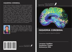 Buchcover von ISQUEMIA CEREBRAL