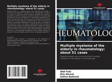 Bookcover of Multiple myeloma of the elderly in rheumatology: about 51 cases