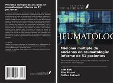 Buchcover von Mieloma múltiple de ancianos en reumatología: informe de 51 pacientes
