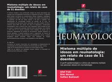 Buchcover von Mieloma múltiplo de idosos em reumatologia: um relato de caso de 51 doentes