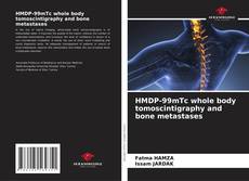 Bookcover of HMDP-99mTc whole body tomoscintigraphy and bone metastases