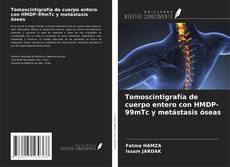 Buchcover von Tomoscintigrafía de cuerpo entero con HMDP-99mTc y metástasis óseas