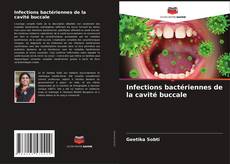 Copertina di Infections bactériennes de la cavité buccale
