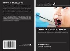 Buchcover von LENGUA Y MALOCLUSIÓN