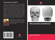Buchcover von Microssomia hemifacial