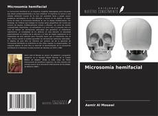 Couverture de Microsomía hemifacial