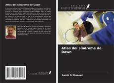 Couverture de Atlas del síndrome de Down