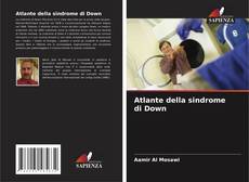 Capa do livro de Atlante della sindrome di Down 