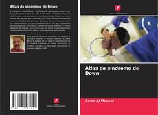 Buchcover von Atlas da síndrome de Down