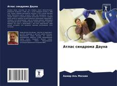 Bookcover of Атлас синдрома Дауна