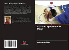 Borítókép a  Atlas du syndrome de Down - hoz