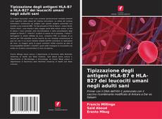 Buchcover von Tipizzazione degli antigeni HLA-B7 e HLA-B27 dei leucociti umani negli adulti sani