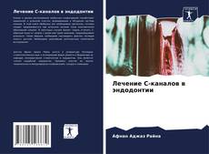 Buchcover von Лечение С-каналов в эндодонтии