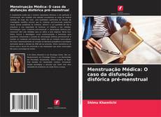Buchcover von Menstruação Médica: O caso da disfunção disfórica pré-menstrual