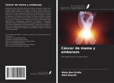 Buchcover von Cáncer de mama y embarazo
