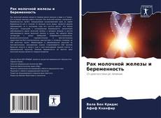 Bookcover of Рак молочной железы и беременность