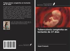 Tuberculosis congénita en lactante de 37 días kitap kapağı