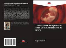 Couverture de Tuberculose congénitale chez un nourrisson de 37 jours