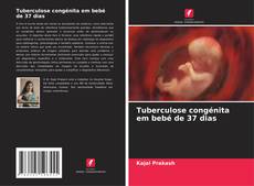 Portada del libro de Tuberculose congénita em bebé de 37 dias