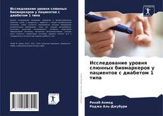 Bookcover of Исследование уровня слюнных биомаркеров у пациентов с диабетом 1 типа