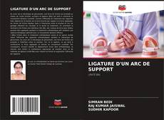 LIGATURE D'UN ARC DE SUPPORT kitap kapağı
