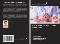 Capa do livro de LIGADURA DE ARCOS DE BRACKETS 