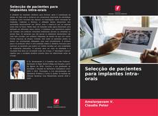 Copertina di Selecção de pacientes para implantes intra-orais