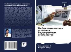 Bookcover of Выбор пациента для установки внутриротовых имплантатов