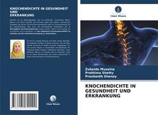 Couverture de KNOCHENDICHTE IN GESUNDHEIT UND ERKRANKUNG