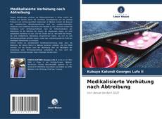 Buchcover von Medikalisierte Verhütung nach Abtreibung