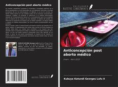 Buchcover von Anticoncepción post aborto médico