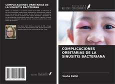 Buchcover von COMPLICACIONES ORBITARIAS DE LA SINUSITIS BACTERIANA