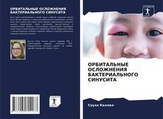 Bookcover of ОРБИТАЛЬНЫЕ ОСЛОЖНЕНИЯ БАКТЕРИАЛЬНОГО СИНУСИТА