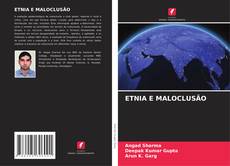 ETNIA E MALOCLUSÃO的封面