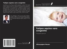 Talipes equino varo congénito kitap kapağı