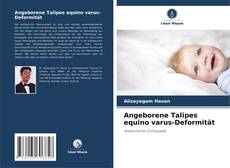 Angeborene Talipes equino varus-Deformität的封面
