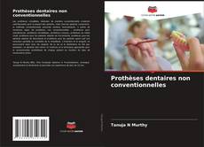 Bookcover of Prothèses dentaires non conventionnelles