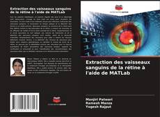Bookcover of Extraction des vaisseaux sanguins de la rétine à l'aide de MATLab