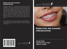 Capa do livro de Reducción del esmalte interproximal 
