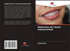 Bookcover of Réduction de l'émail interproximal