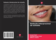 Bookcover of Redução interproximal do esmalte