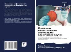 Buchcover von Коллекция инфекционного эндокардита: клинические случаи
