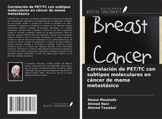 Buchcover von Correlación de PET/TC con subtipos moleculares en cáncer de mama metastásico