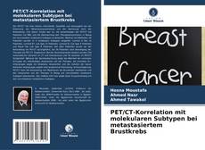 Bookcover of PET/CT-Korrelation mit molekularen Subtypen bei metastasiertem Brustkrebs