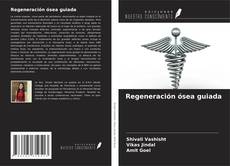 Buchcover von Regeneración ósea guiada