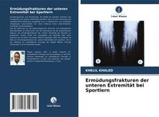 Bookcover of Ermüdungsfrakturen der unteren Extremität bei Sportlern