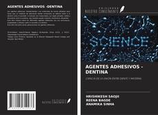 Buchcover von AGENTES ADHESIVOS -DENTINA