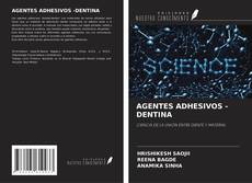 Copertina di AGENTES ADHESIVOS -DENTINA
