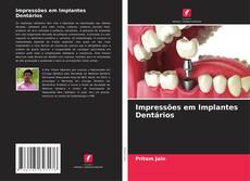 Capa do livro de Impressões em Implantes Dentários 